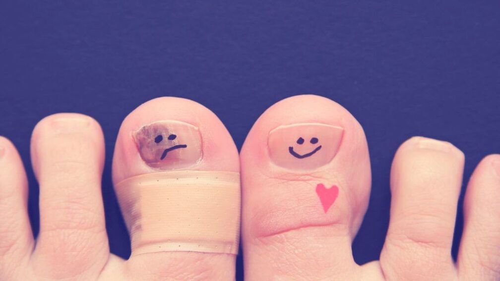 Why is nail fungus dangerous