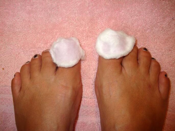 anti-fungal lotions on the feet