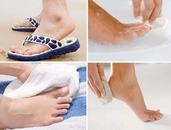 Fungi prevention