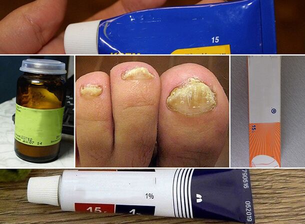 General principles for fungus treatment