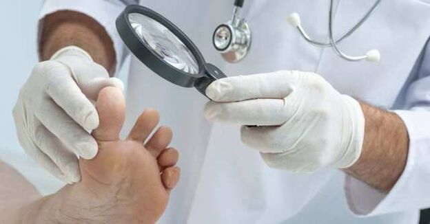 foot examination for fungal infections