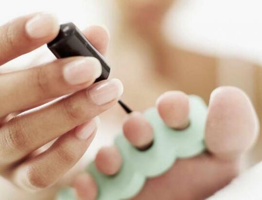 treating nails with nail polish for fungal infection