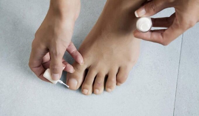 treatment of fungus on the big toe varnish